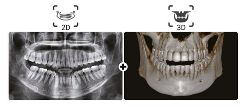 2D рентгеновский снимок и 3D-томограмма